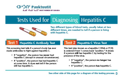 Tests Used for Diagnosing Hepatitis C